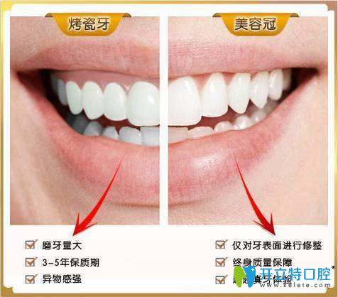 【图】女士站立手势图片曝光五种手位让你学会正确站姿(图1)