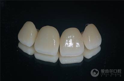 烤瓷牙断了怎么办?(图1)