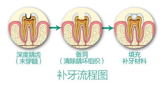 治疗牙齿过程(图1)