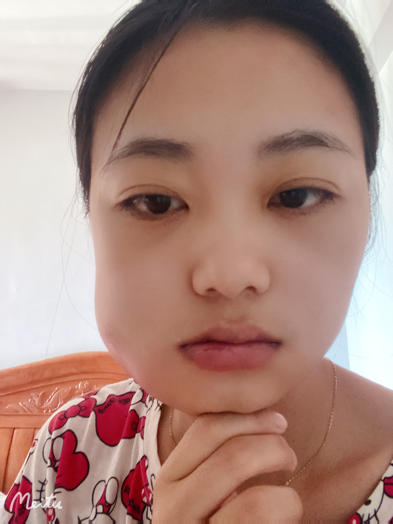 拔智齿的脸型会塌陷吗(图1)