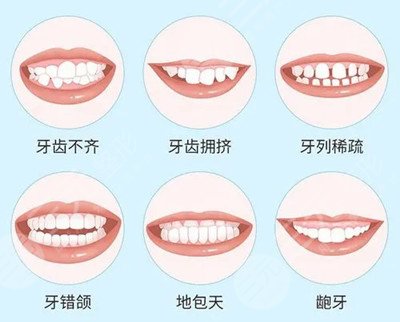 牙齿矫正一般价钱多少(图1)