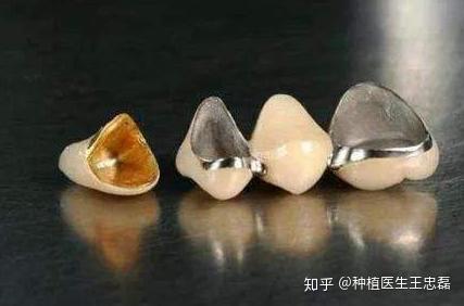 北大口腔医院牙体牙髓科科普号(图1)