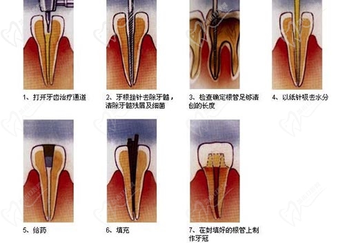 口腔美容怎么样？口腔美容技术专业就业前景？(图1)