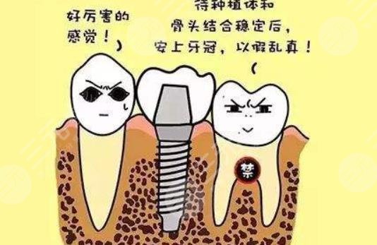 烤瓷牙如何装_邬利波医生的语音科普_妙手医生(图1)
