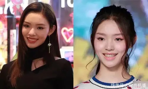 烤瓷牙脱落怎么办(图1)