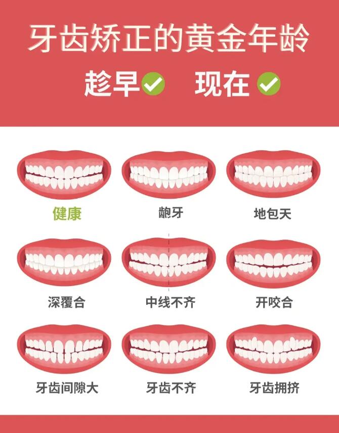 牙齿矫正最佳年龄段(图1)