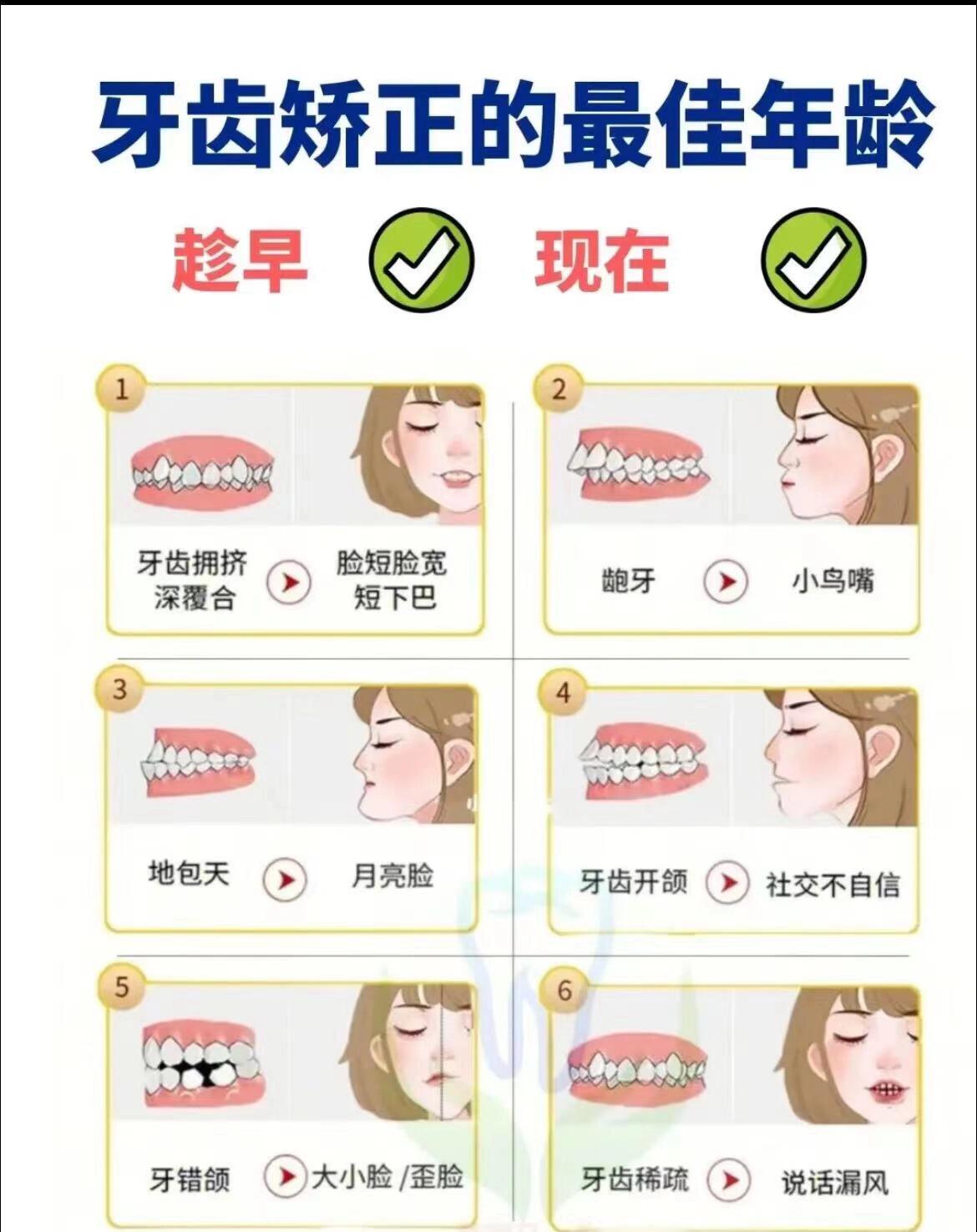 牙齿矫正最佳年龄和最晚年龄(图1)