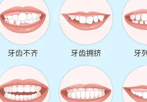 矫正牙齿的最佳年龄(图1)